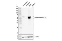 Cell Signaling Technology Glutaminase-1/GLS1 E4T9Q Rab