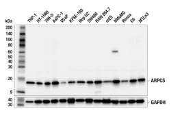 Cell Signaling Technology&nbsp;ARPC5 F5F6V Rabbit mAb 100 u