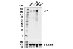 Cell Signaling Technology&nbsp;UTY E3C2J Rabbit mAb 100 ul