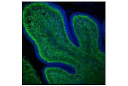 Cell Signaling Technology&nbsp;Doublecortin F6K9E Rabbit mA