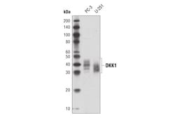 Cell Signaling Technology&nbsp;DKK1 D5V6L Rabbit mAb 100 ul