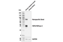 Cell Signaling Technology&nbsp;FBP2/FBPase 2 E9M5T Rabbit m