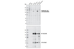 Cell Signaling Technology Phospho-NF-kappa-B2 p100 Ser8