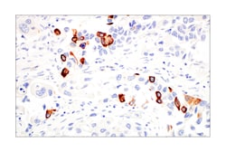 Cell Signaling Technology&nbsp;Keratin 14 LL002 Mouse mAb 1