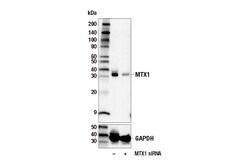 Cell Signaling Technology&nbsp;MTX1 E5L8N Rabbit mAb 100 ul