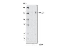 Cell Signaling Technology&nbsp;ULK1 A705 Antibody 20 ul