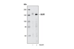 Cell Signaling Technology&nbsp;ULK1 R600 Antibody 20 ul