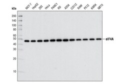 Cell Signaling Technology&nbsp;Translation Initiation Complex