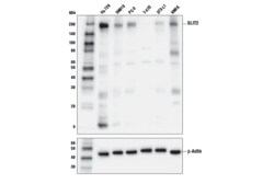 Cell Signaling Technology&nbsp;SLIT2 E8W7Y Rabbit mAb 100 u