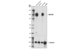 Cell Signaling Technology SAP102 A7R8L Rabbit mAb 100