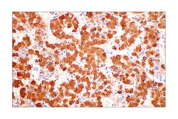 Cell Signaling Technology POMC AH26 Mouse mAb 100 ul