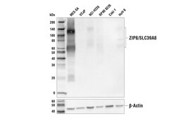 Cell Signaling Technology ZIP8/SLC39A8 E3V8K Rabbit mA