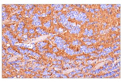 Cell Signaling Technology VGLUT1 E8L5B Rabbit mAb 100