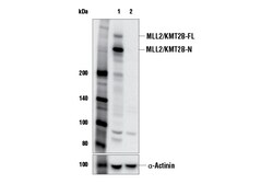 Cell Signaling Technology MLL2/KMT2B E3M1V Rabbit mAb