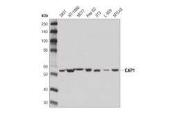 Cell Signaling Technology CAP1 D2K3J Rabbit mAb 100 ul