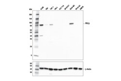 Cell Signaling Technology PKC-beta D3E7O Rabbit mAb 10