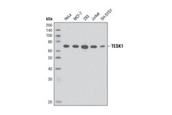Cell Signaling Technology TESK1 D49D4 Rabbit mAb 20 ul
