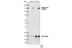Cell Signaling Technology&nbsp;TrkA and TrkB Antibody Sampler