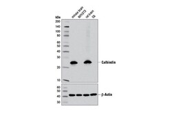 Cell Signaling Technology Calbindin D1I4Q XPR Rabbit