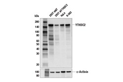 Cell Signaling Technology YTHDC2 E6H7U Rabbit mAb 100