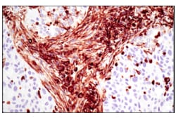 Cell Signaling Technology Vimentin D21H3 XPR Rabbit