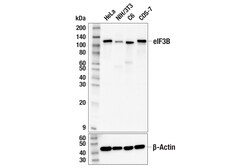 Cell Signaling Technology&nbsp;eIF3B F1E6A Rabbit mAb 100 u