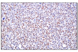 Cell Signaling Technology&nbsp;TCF4/ITF2 E3X2Y Rabbit mAb 1