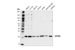 Cell Signaling Technology&nbsp;CRYAB D6S9E Rabbit mAb 100 u