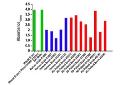 Cell Signaling Technology&nbsp;PathScanR RP Phospho-Tau Th