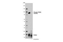 Cell Signaling Technology Phospho-PSD95 Ser295 A8F8Z