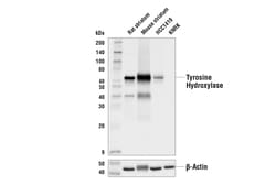 Cell Signaling Technology Tyrosine Hydroxylase LNC1 Mo
