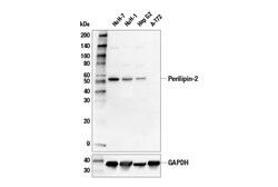 Cell Signaling Technology Perilipin-2 Antibody 100 ul