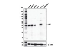 Cell Signaling Technology&nbsp;LAT E3U6J XP R  Rabbit mAb