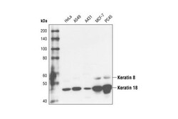 Cell Signaling Technology&nbsp;Keratin 8/18 C51 Mouse mAb 2