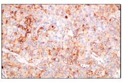 Cell Signaling Technology&nbsp;CD58 F1C9B Rabbit mAb 100 ul