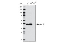 Cell Signaling Technology Keratin 17 D73C7 Rabbit mAb