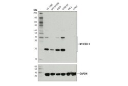 Cell Signaling Technology&nbsp;NY-ESO-1 D1Q2U Rabbit mAb 10