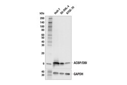 Cell Signaling Technology ACBP/DBI E6K8G XPR Rabbit
