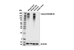 Cell Signaling Technology&nbsp;Cav2.2/CACNA1B E2Q1Y Rabbit