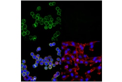 Cell Signaling Technology&nbsp;HER2/ErbB2 29D8 Rabbit mAb