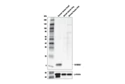Cell Signaling Technology&nbsp;S100A7 E7X2C Rabbit mAb 100