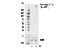 Cell Signaling Technology&nbsp;Phospho-ATM Ser1981 10H11.E