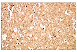 Cell Signaling Technology&nbsp;beta-3-Tubulin E9F3E Mouse m