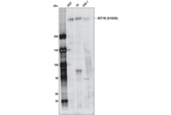 Cell Signaling Technology&nbsp;SET1B D1U5D Rabbit mAb 100 u