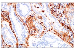 Cell Signaling Technology&nbsp;Filamin A E8P8M Rabbit mAb 1