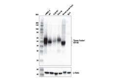 Cell Signaling Technology&nbsp;Tissue Factor/CD142 E2L3B Ra