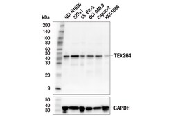 Cell Signaling Technology&nbsp;TEX264 E2J3J Rabbit mAb 100