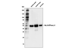 Cell Signaling Technology&nbsp;Na K-ATPase beta-1 D6U8Q Rab
