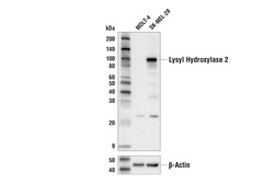 Cell Signaling Technology Lysyl Hydroxylase 2 Antibody 1