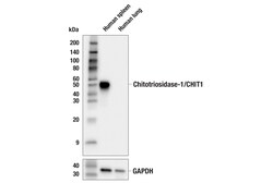 Cell Signaling Technology&nbsp;Chitotriosidase-1/CHIT1 E4X4I